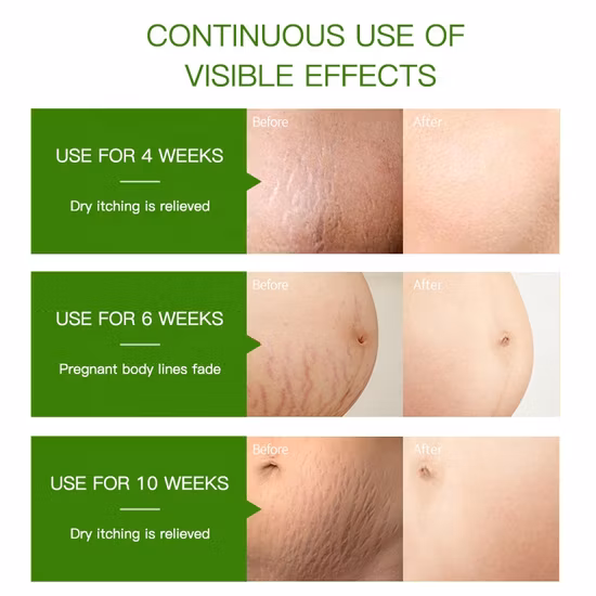 Großhandel 100 % reines Haar, Gesicht, Körper, Massage, Dehnungsstreifen, Entfernung von Aromatherapie-Spender, Jasmin-ätherisches Öl-Duft